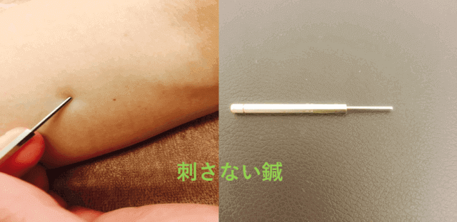 刺さない鍼