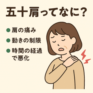 五十肩ってなに？というタイトルと、肩の痛み・動きの制限・時間の経過で悪化すると説明した五十肩のイラスト画像